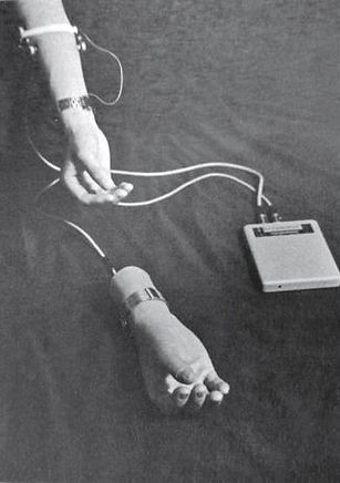 照片为左上角的人类手臂,控制着一只名为“维也纳手”的高仿真度肌电手